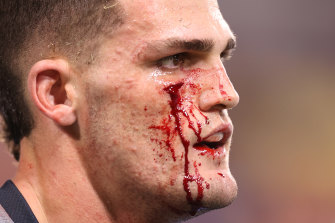 Referee Gerard Sutton said he told Nathan Cleary twice to stop the bleeding before sending him off. 