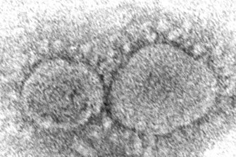 The SARS-CoV-2 virus particles which cause COVID-19. 