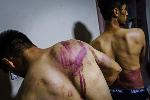 Journalists from the Etilaatroz newspaper, Nemat Naqdi, 28, a video journalist, left and Taqi Daryabi, 22, video editor, undress to show wounds sustained after Taliban fighters tortured and beat them while in custody, after they were arrested for reporting on a women’s rights protest in Kabul.