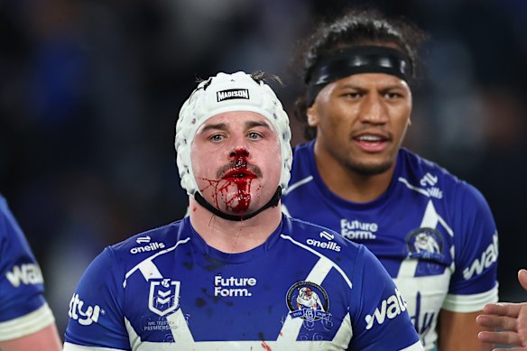 Tough Dog: Reed Mahoney had a challenging final season at the Bulldogs in 2025. 