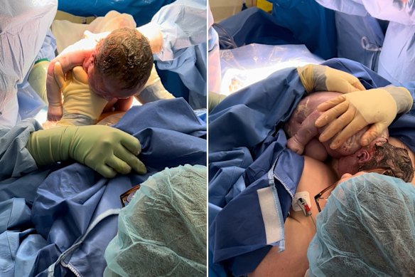 Sassica Francis-Bruce gave birth to her now-two-year-old son through maternal assisted caesarean.