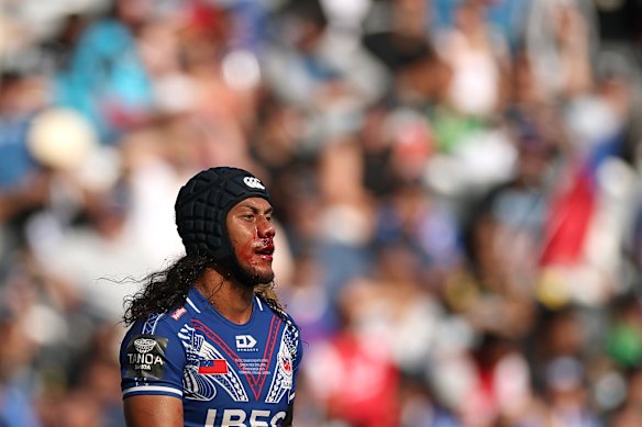 A bloodied Jarome Laui.