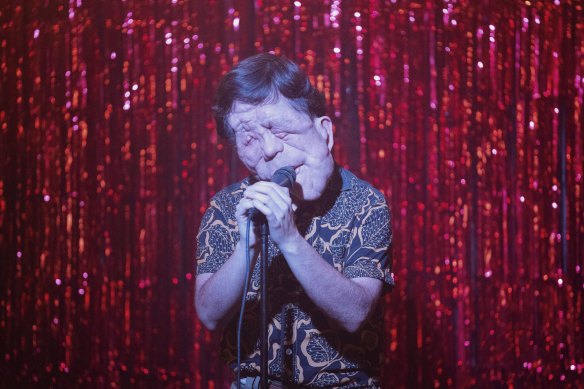 “The two easiest ways to lose your anonymity in society is to have a disfigurement of some kind, or to be a celebrity”: Adam Pearson in A Different Man.