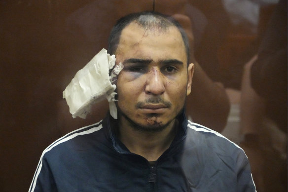 Saidakrami Murodali Rachabalizoda, a suspect in the Crocus City Hall shooting, with facial injuries and a large bandage on his ear. 