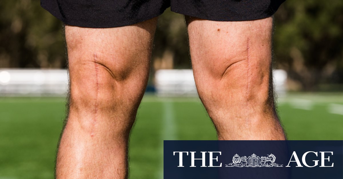 Knee reconstructions: Australian knee-replacement rates show the problems with Medicare - Vimarsana News