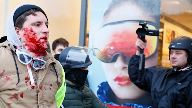 A bleeding demonstrator is taken away by police officers during a yellow vest protest on Saturday in Paris. 