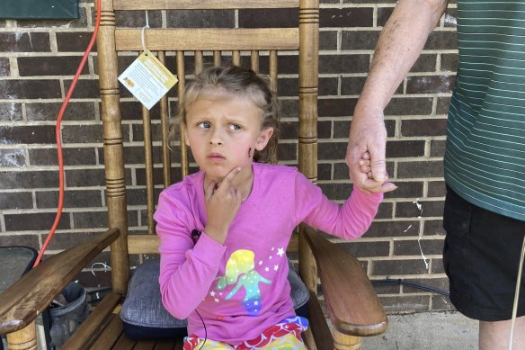 Kinsley White, 6, shows reporters a wound on her face.