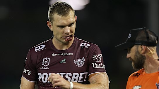 Star Sea Eagles fullback Tom Trbojevic left the field with a groin injury yesterday.