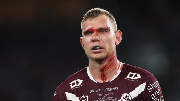 Tom Trbojevic’s fitness once again holds to key for Manly.