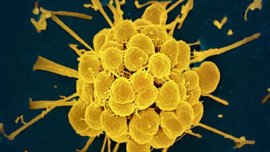 The Neisseria gonorrhoeae bacteria, which causes gonorrhea.