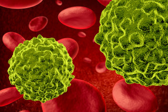 Blood cancers, including leukaemia and lymphoma, are now the second most common and deadly form of cancer, according to new figures from the Leukaemia Foundation.