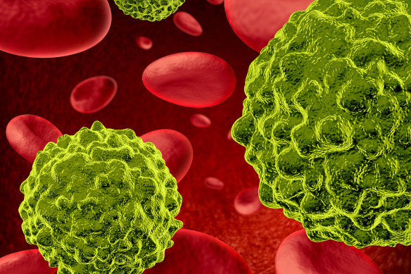 Blood cancers, including leukaemia and lymphoma, are now the second most common and deadly form of cancer, according to the Leukaemia Foundation.