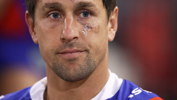 Down and out: A dejected Mitchell Pearce looks on from the sideline after suffering a suspected corked thigh.