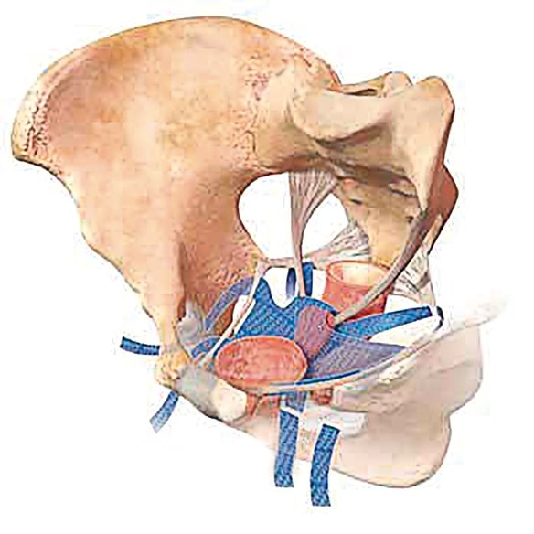 An illustration of how one mesh device, the Prolift, was used.