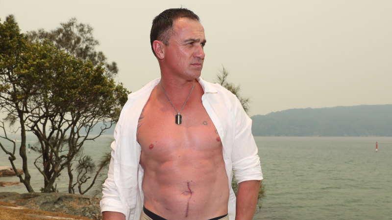 Shannon Noll still feels the pain from Dancing with the Stars back crack