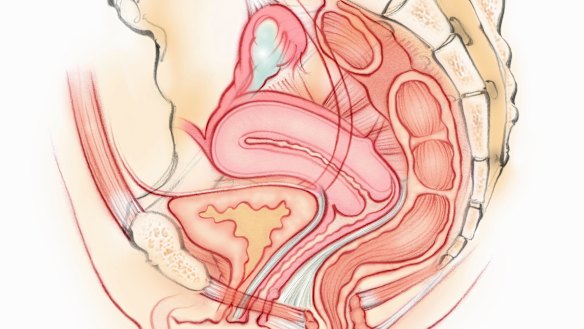 The theory was that "scratching" or "injuring" a woman’s endometrium made it more susceptible to embryo implantation.