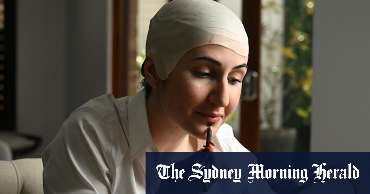 Everywhere you look this weekend, women will be wearing bald caps. If you know, you know
