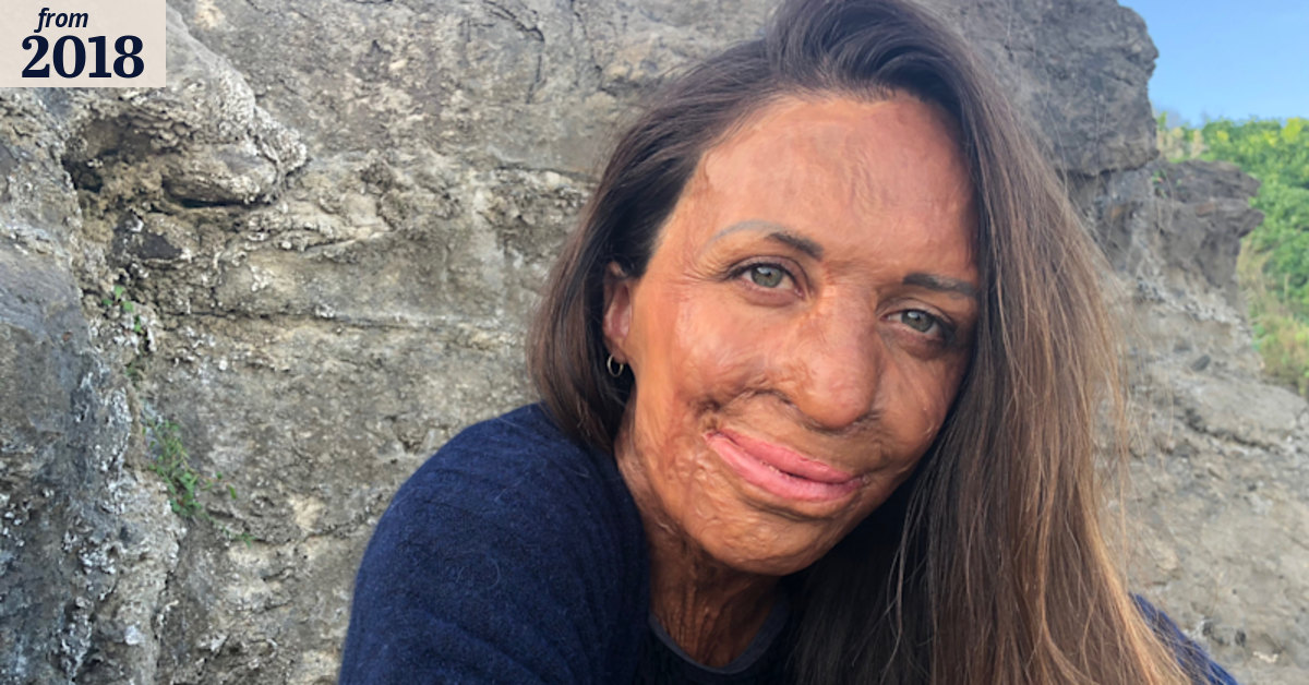 Turia Pitt: 