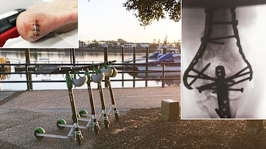 Brisbane Lime scooter riders Viktor Vukovic (inset right) and Jordan Madigan (inset left) have been injured riding Lime scooters when their front wheel seized.
