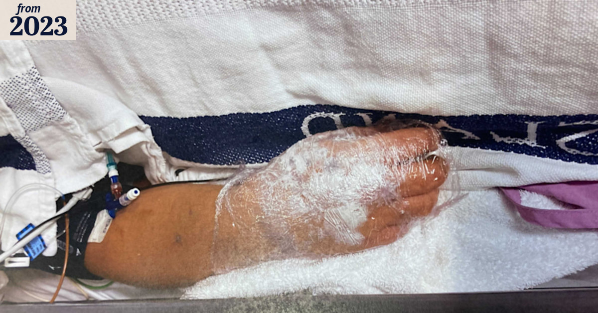 Arrest warrant issued for man over alleged acid attack on Brisbane street