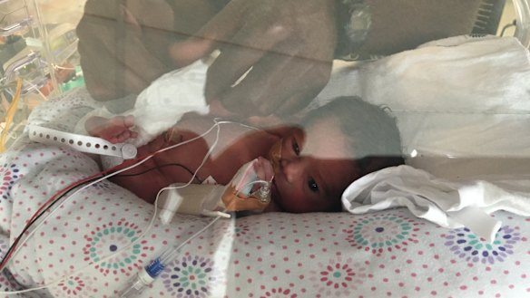 Zoe Charles in Nepean Hospital's NICU.