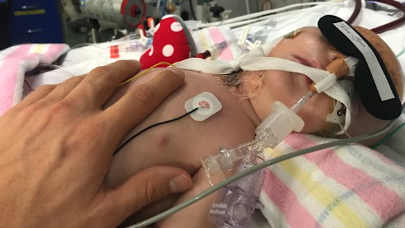 Jasper Waters connected to the ECMO machine in May 2017.