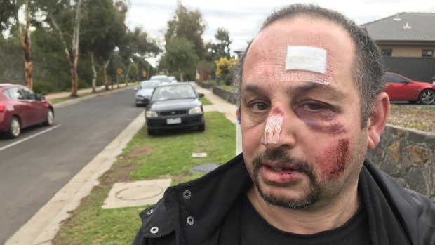 Security guard Charlie was left with a fractured eye socket and broken nose after the assault in Truganina.