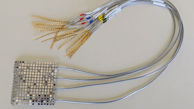 The AI uses data from intracranial electrodes like these, that are inserted under the skull on the surface of the brain.