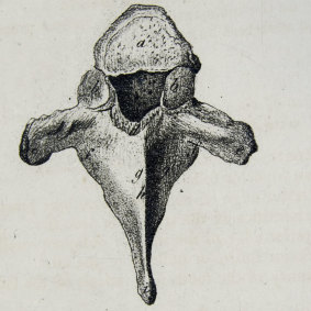 This anatomical drawing, by Scottish artist and anatomist Andrew Fyfe (1752-1824), shows the first dorsal vertebrae.