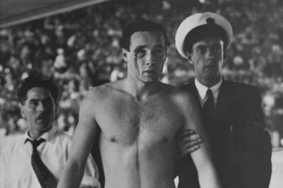Ervin Zador, Hungarian water polo player, injured in match between Russia and Hungary in the 1956 Olympic Games.