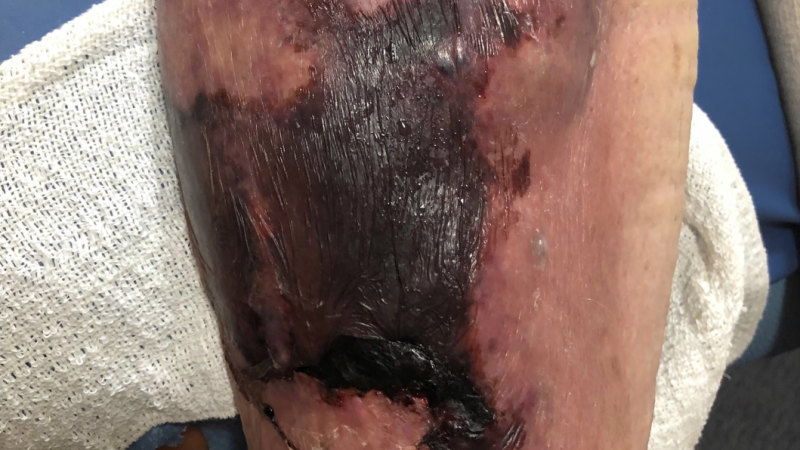 Aged-care nightmare: from walking and talking to dead in three months