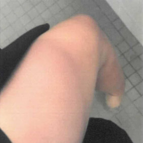 A photo tendered in court in Bruce Lehrmann’s defamation trial of what Brittany Higgins has described as a bruise on her leg.