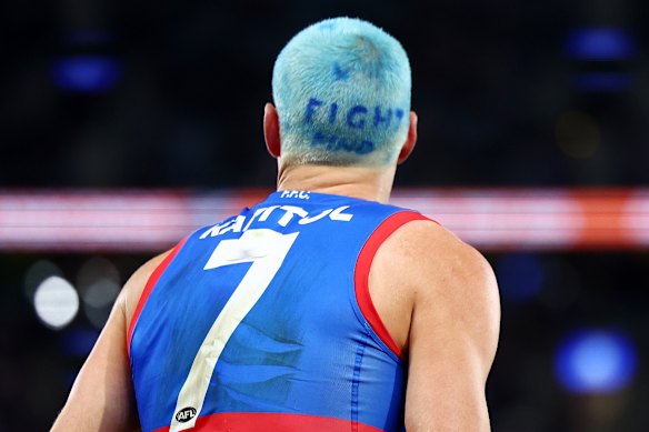 Rory Lobb dyed his hair blue for Fight MND.