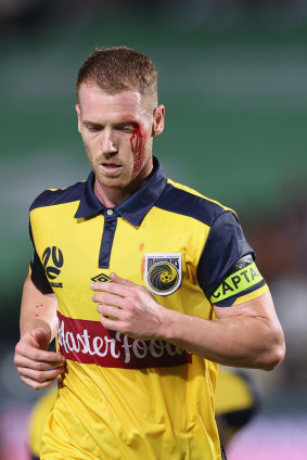 A bloodied Oliver Bozanic of Central Coast.