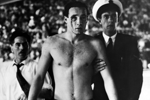 Erwin Zador injured in a water polo 
incident in 1956 Olympics in Melbourne between Russia and Hungary.