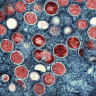 A colourised transmission electron micrograph of mpox particles, which are red.