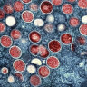 A colorised transmission electron micrograph of mpox particles (red) found within an infected cell (blue), cultured in the laboratory.