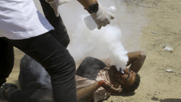 A Palestinian medic treats a protester shot in the face with a teargas canister on Friday. 