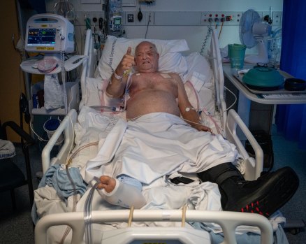 Traffic controller Michael De Vos had never suffered a single broken bone before he was hit by a car on Kelvin Grove Road.