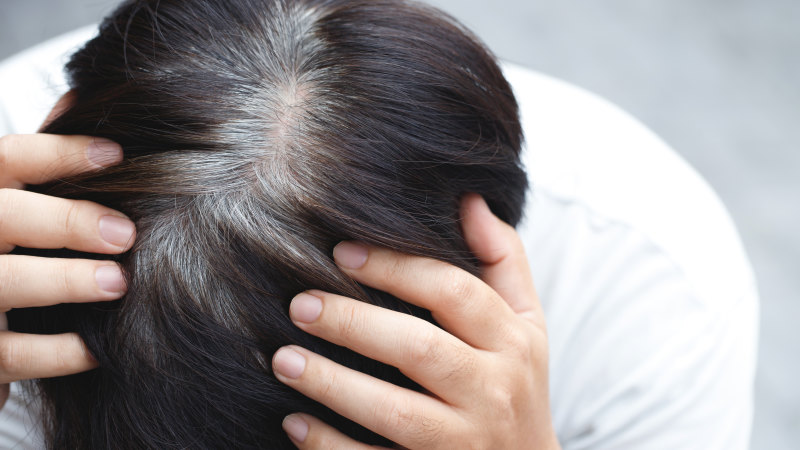 Can stress actually turn your hair grey?