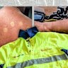 Australia’s posties began reporting sunburnt arms and backs. This is why