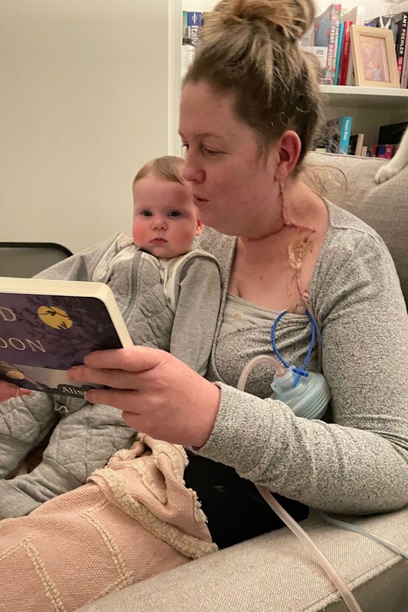 Pauline Ryan during her treatment for melanoma.