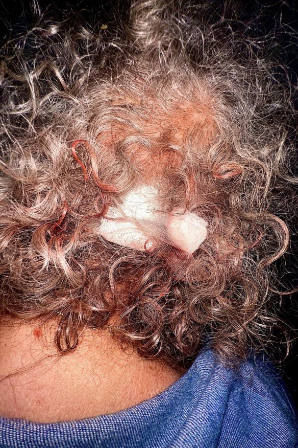 A woman’s head was injured when she fell in a Sydney group home operated by Beyond Care.