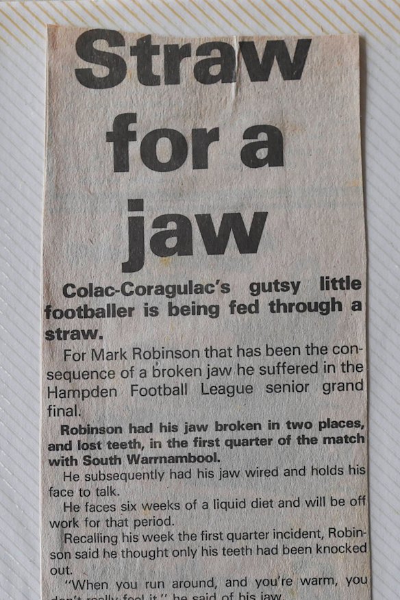 A newspaper clipping about Butch Robinson’s broken jaw, from his scrapbook.