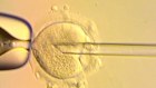 A nuclear genome from an egg carrying a mitochondrial DNA mutation is being inserted into an egg donated by an unaffected woman.