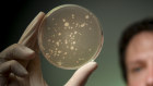 A bacterial agar plate showing anaerobic bacteria. The discovery of the human microbiome could fundamentally change the way we treat a variety of diseases.