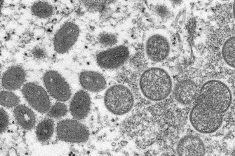 An electron microscope image shows mature, oval-shaped monkeypox virions.