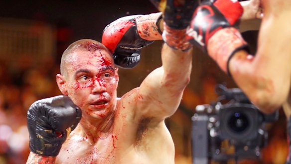 Tim Tszyu copped a terrible head cut in his bout against Sebastian Fundora in March.