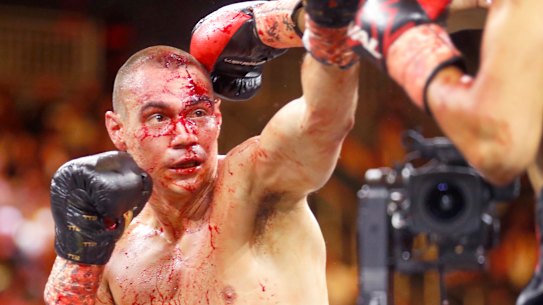 Tim Tszyu copped a horrific head cut against Sebastian Fundora in March.