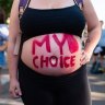 A slogan written on an abortion rights demonstrator’s body, outside the US Supreme Court in Washington, DC, on Saturday, June 25.